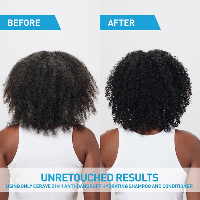 2-in-1 Anti-Dandruff Hydrating Shampoo and Conditioner