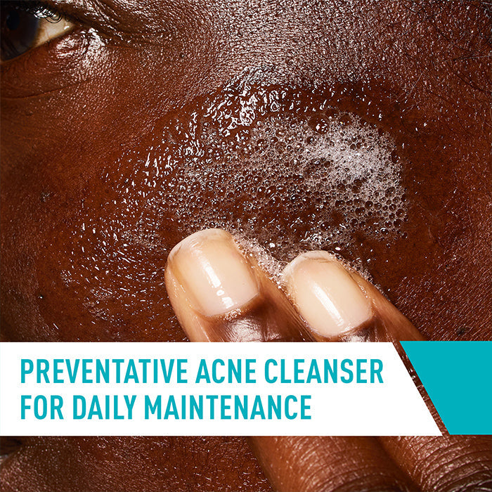 Acne Control Cleanser