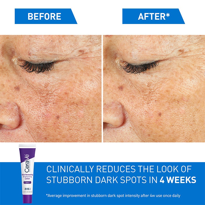 Skin Renewing Brightening Lotion with SPF 30
