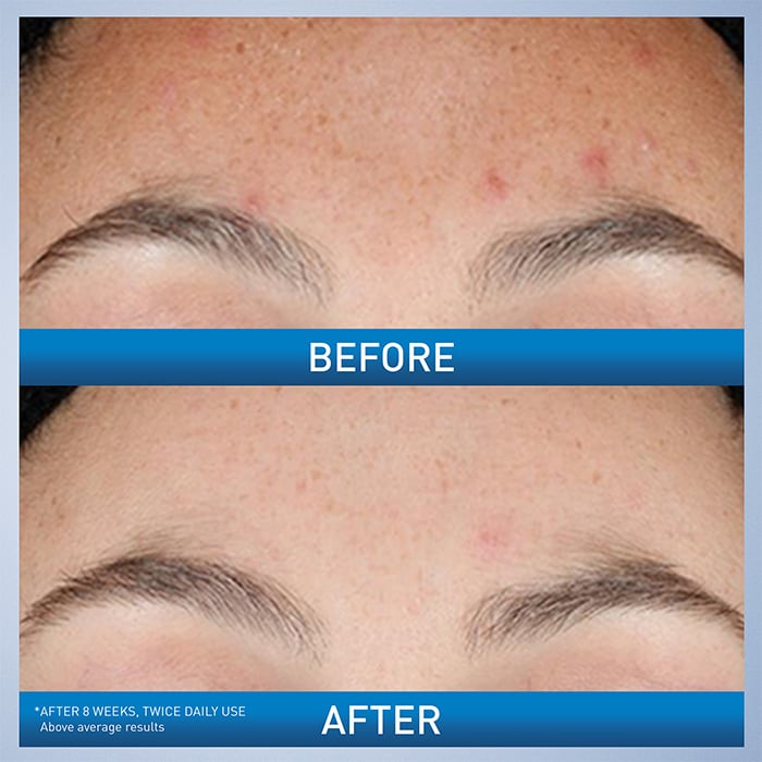 Resurfacing Retinol Serum