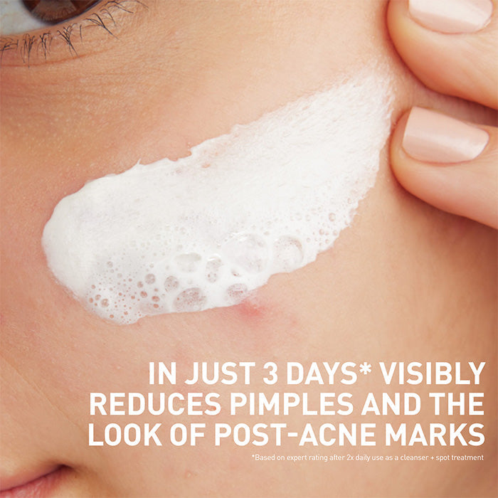 Acne Clay To Foam Cleanser