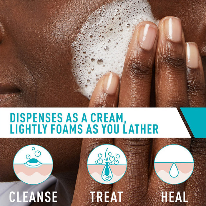 Acne Foaming Cream Cleanser