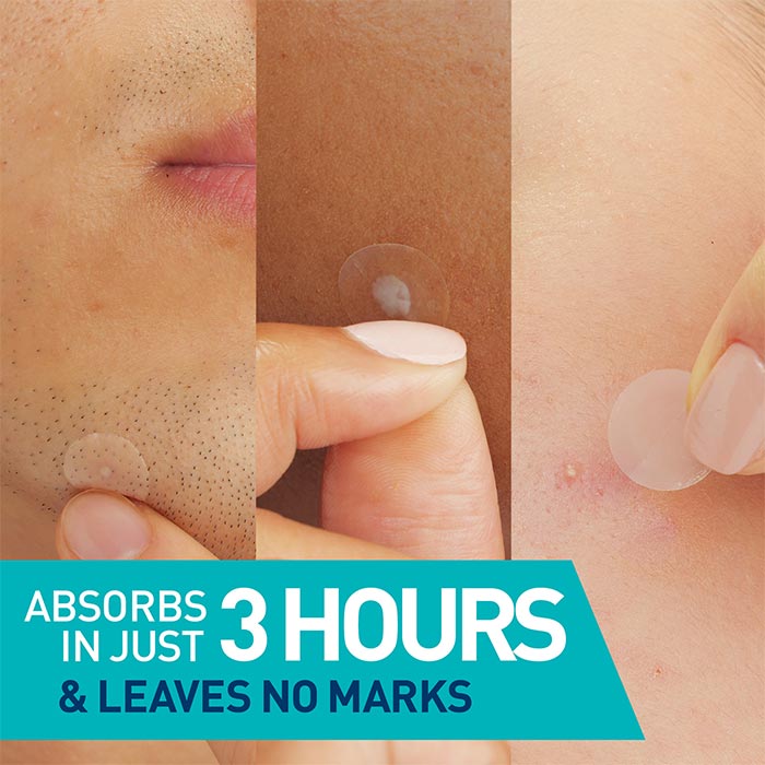 Blemish Barrier Patches